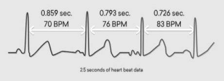 Heart Rate Variability(HRV)