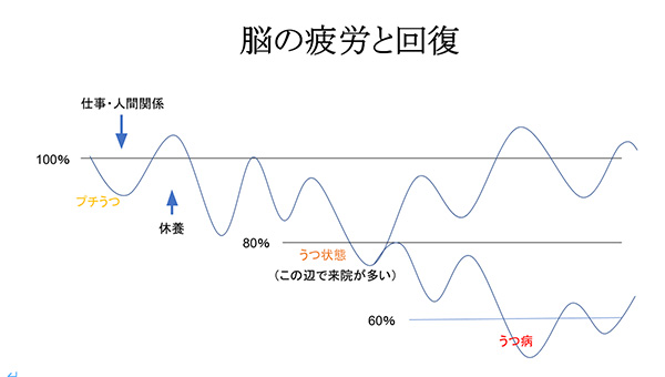 脳の疲労と回復