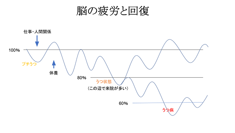 うつ うつ病についてのまとめ 桜木町駅から徒歩3分の心療内科 内科 精神科 こころとからだ横浜クリニック